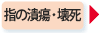 間歇性跛行